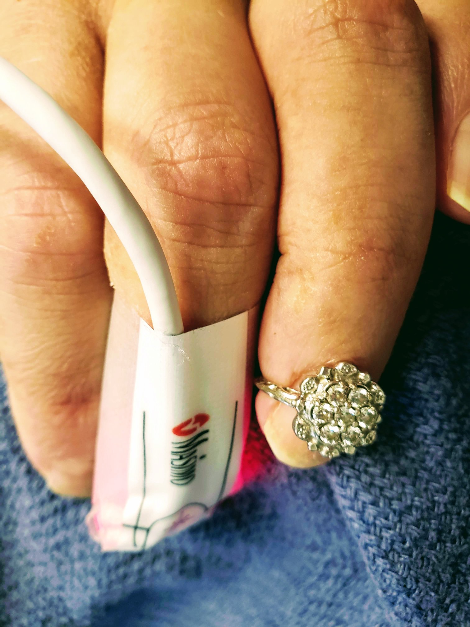 Day +83: Let non-freedom ring