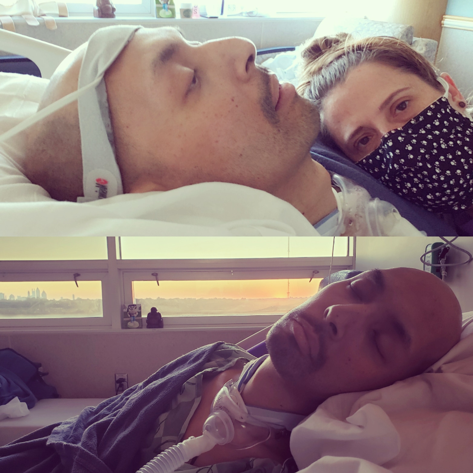 Day +93 (today): Hospital Day 100 (yesterday)